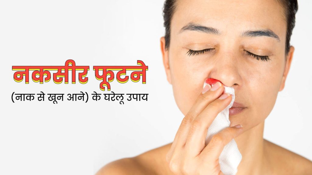 Nose bleeding in summer: गर्मियों में नाक से खून निकलता है? इसका इलाज इन नुस्खों से करें Nose bleeding in summer: गर्मियों में नाक से खून निकलता है? इसका इलाज इन नुस्खों से करें