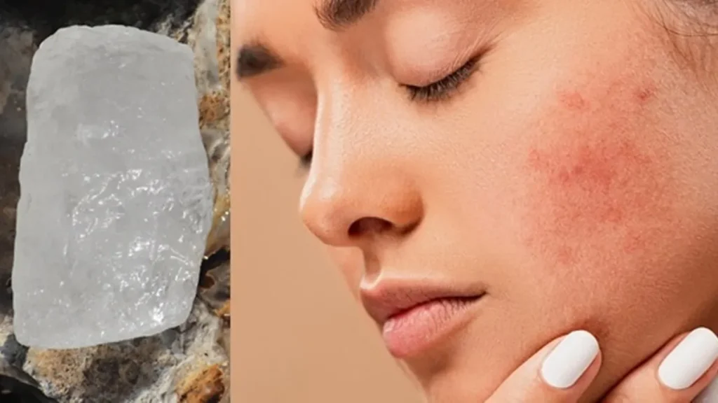 Fitkari For Face: चेहरे पर फिटकरी लगाने के फायदे, लेकिन भूलकर भी न करें ये गलतियाँ