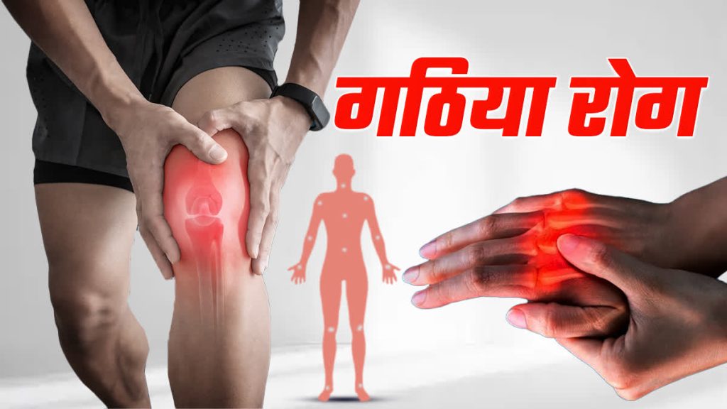 Arthritis Symptoms: गठिया का दर्द कहां-कहां होता है? जानिए कारण और लक्षण Arthritis Symptoms: गठिया का दर्द कहां-कहां होता है? जानिए कारण और लक्षण