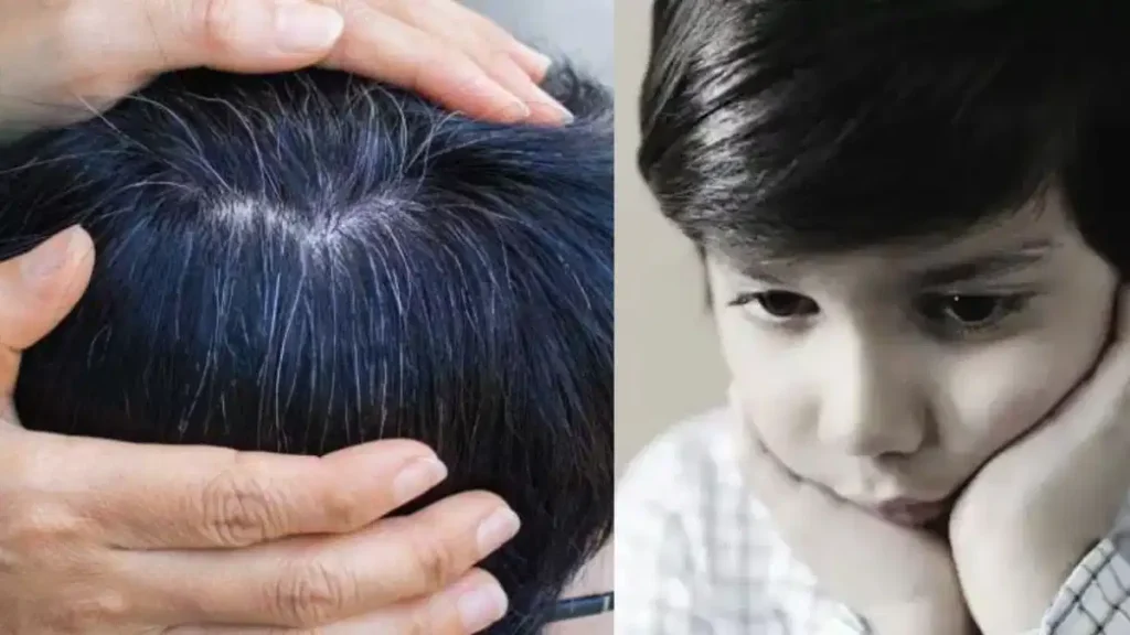 White Hair Causes: कम उम्र में बाल सफेद होने की समस्या- कारण, लक्षण और बचाव के आसान उपाय