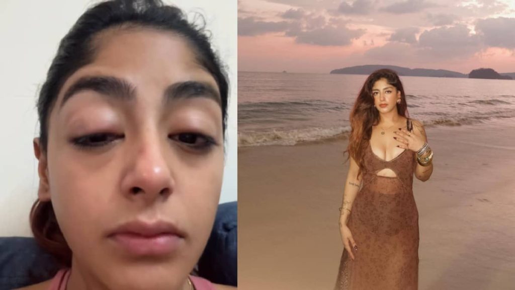 मुंबई क्लब में ‘स्प्लिट्सविला X6’ फेम प्रीत सिंह पर हमला, टूटा दांत और सूजा चेहरा; सुरक्षा पर उठे सवाल