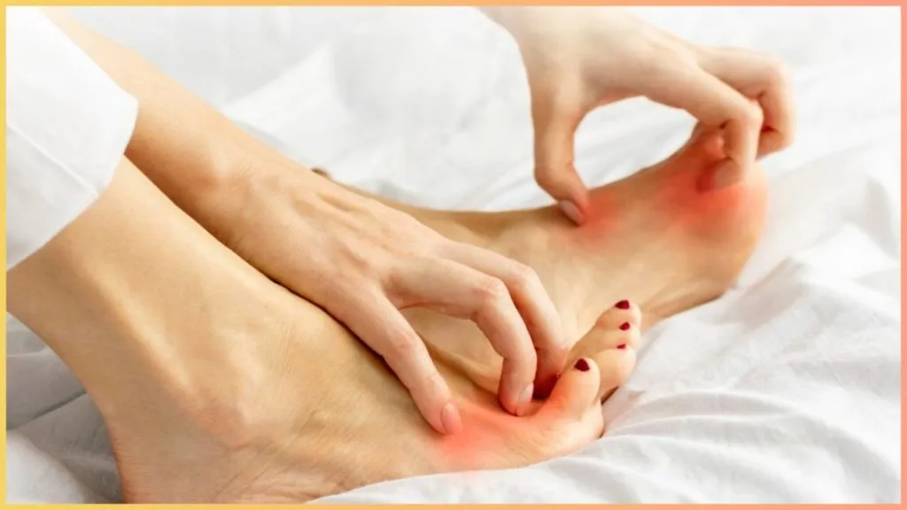 Monsoon Skin Care Tips: बारिश के मौसम में फंगल इंफेक्शन से कैसे बचें, जानें जरूरी सावधानियां और घरेलू उपाय